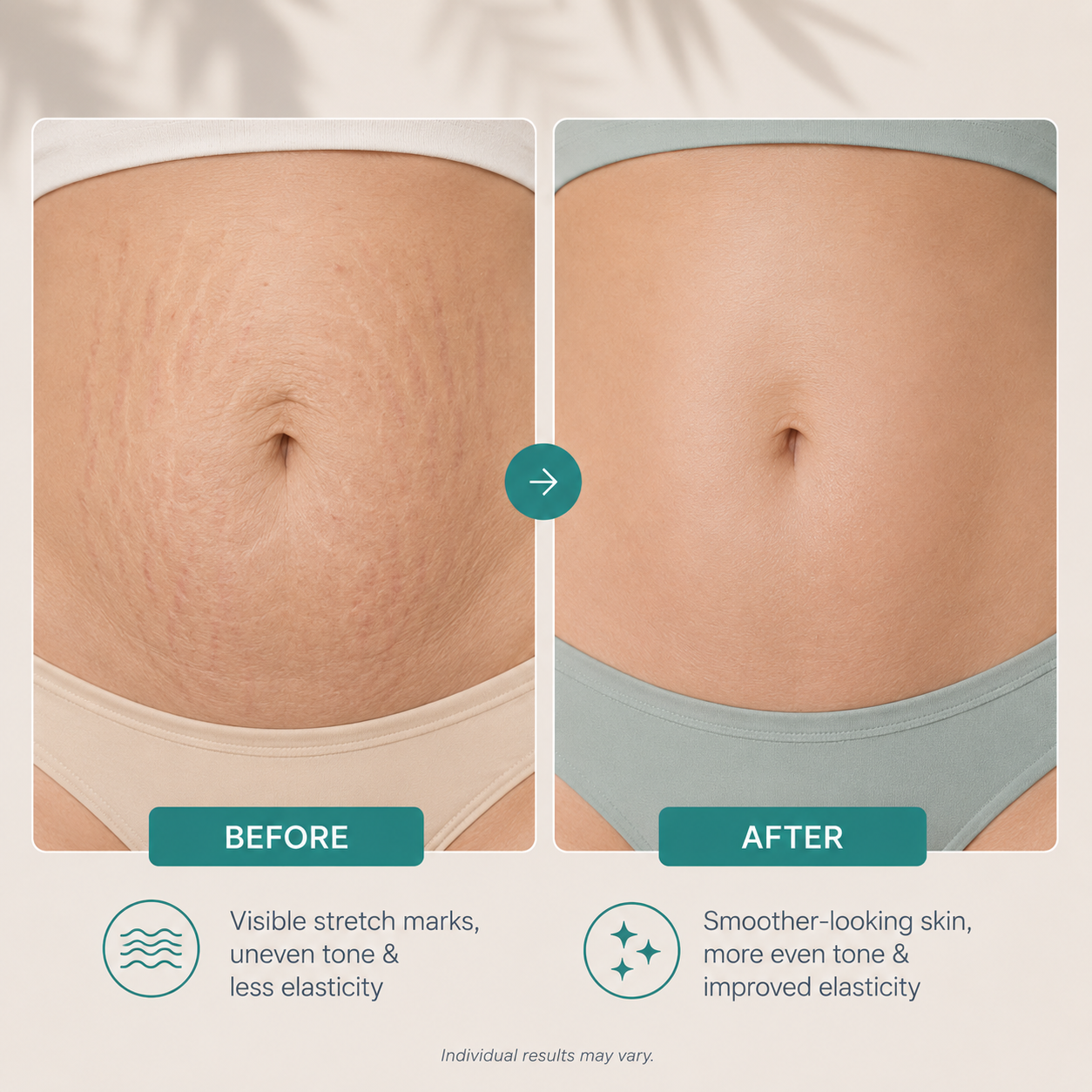 Pro-Grade Anti-Stretch Marks Cream